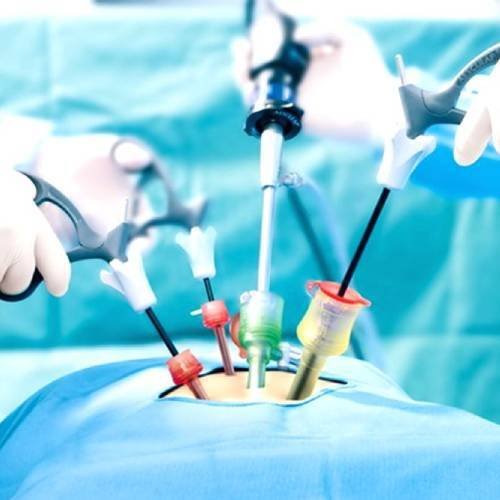 Laparoscopy